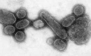 1918-spanish-flu-epidemic-1.jpg